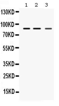 Anti-MEFV Antibody