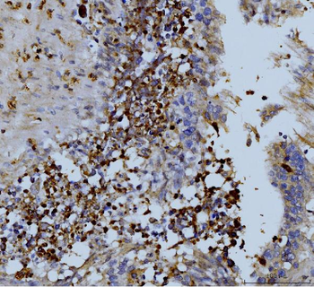 Anti-MMP9 Antibody