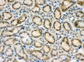 Anti-MMP9 Antibody