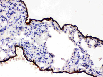 Anti-Mesothelin/MSLN Antibody