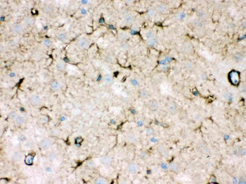 Anti-NDRG2 Antibody