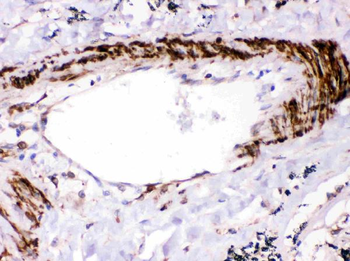 Anti-SHP2/PTPN11 Antibody