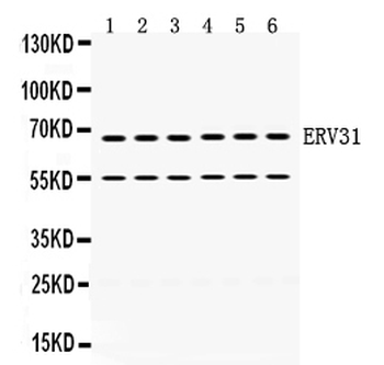 Anti-ERV31/ERV3-1 Antibody