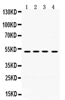 Anti-TIM 1/HAVCR1 Antibody