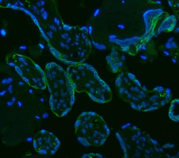 Anti-HSD11B2 Antibody