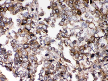 Anti-AIM2 Antibody
