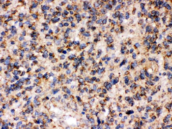 Anti-FE65/APBB1 Antibody