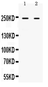 Anti-ARID1A Antibody