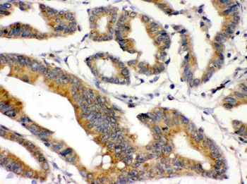 Anti-BMP2 Antibody