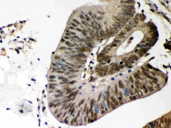 Anti-Caseine Kinase 1 alpha/CSNK1A1 Antibody