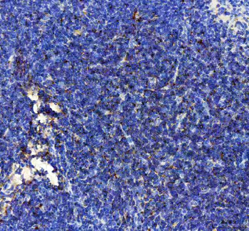 Anti-IP10/CXCL10 Antibody