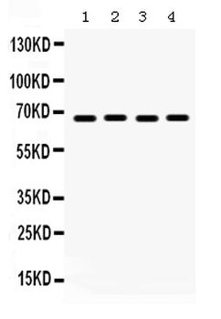 Anti-Pea3/ETV4 Antibody