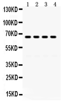 Anti-GRK6 Antibody
