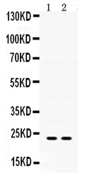 Anti-IGFBP5 Antibody