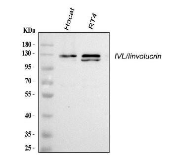 Anti-Involucrin/IVL Antibody