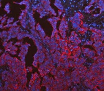 Anti-Cytokeratin 19/KRT19 Antibody