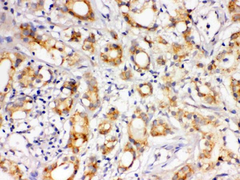 Anti-LOXL1 Antibody