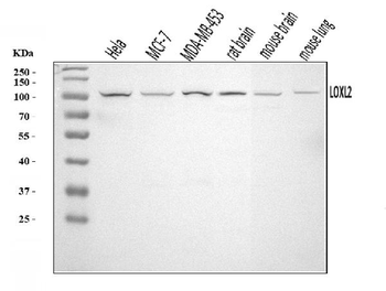 Anti-LOXL2 Antibody