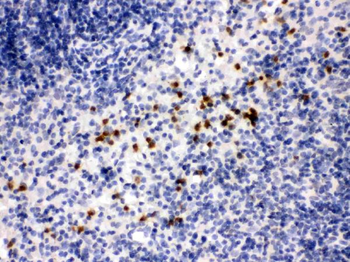 Anti-MMP8 Antibody