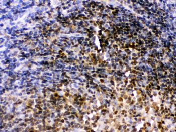 Anti-Pax2 Antibody
