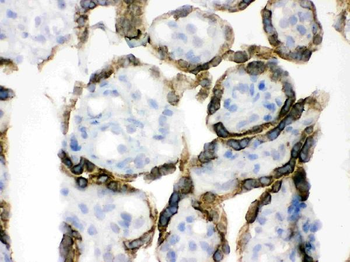 Anti-PDPK1 Antibody