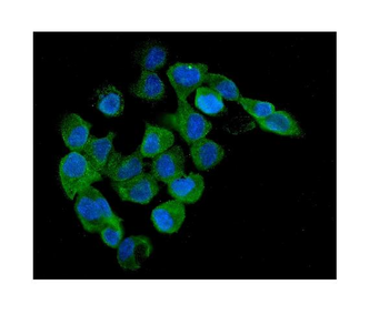 Anti-AMPK beta 1/PRKAB1 Antibody