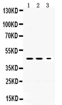 Anti-Neuroserpin/SERPINI1 Antibody