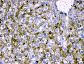 Anti-SLC10A1 Antibody