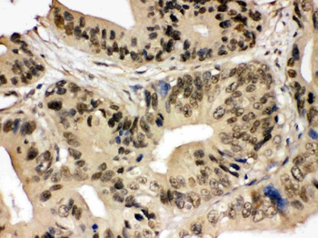 Anti-SMC3 Antibody