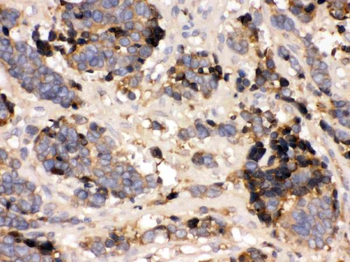 Anti-Prealbumin/TTR Antibody