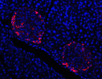 Anti-Prealbumin/TTR Antibody