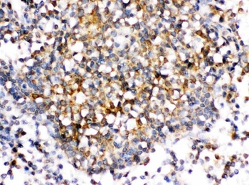 CD153/TNFSF8 Antibody