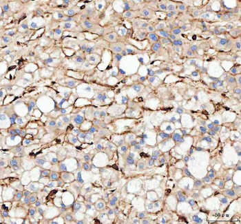 Anti-Actin/ACTA1 Antibody