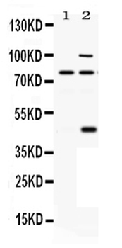 Anti-PACE4/PCSK6 Antibody