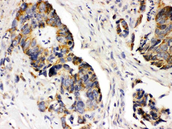 Anti-PDGF Receptor alpha/PDGFRA Antibody