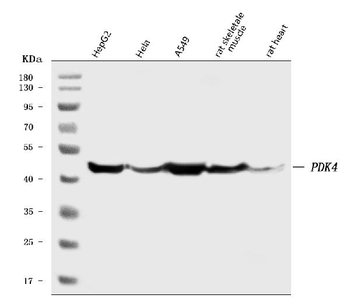 Anti-PDK4 Antibody