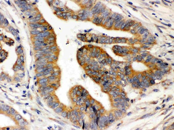 Anti-Rab5/RAB5A Antibody