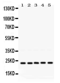 Anti-Rab18 Antibody