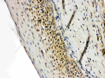 Anti-RAG2 Antibody