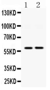 Anti-DGAT1 Antibody
