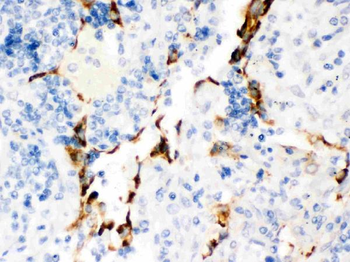 Anti-Kv1.4/KCNA4 Antibody