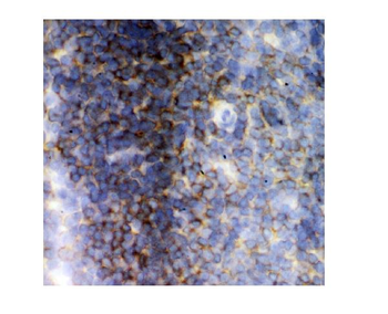 Anti-Lck Antibody
