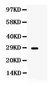 Anti-Aquaporin 0/MIP Antibody