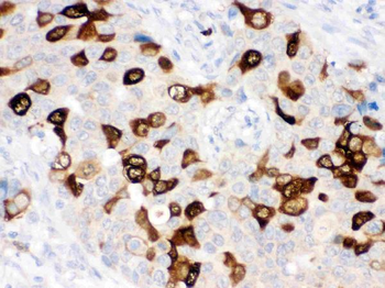 Anti-RRM2 Antibody