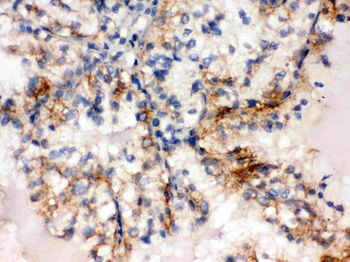 Anti-SULT2A1 Antibody