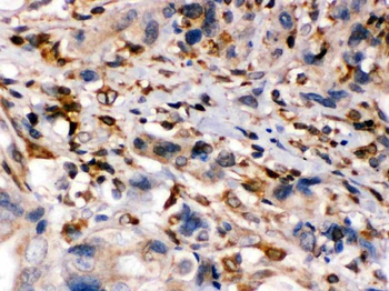 Anti-TAP1 Antibody