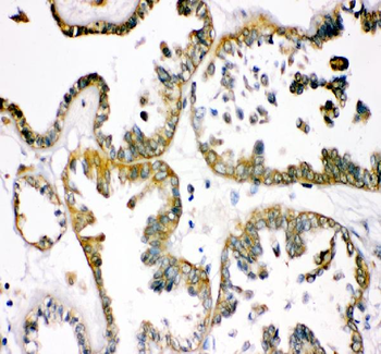 Anti-TCP1 alpha Antibody