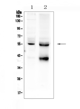 Anti-TGF beta Receptor I/TGFBR1 Antibody