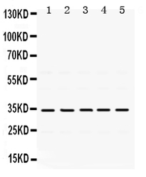 Anti-TIMP3 Antibody