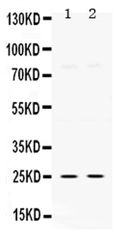 Anti-Thymidine Kinase 1/TK1 Antibody